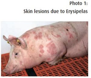 Photo 1 Skin lesions due to Erysipelas